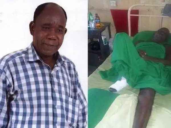 Doctors amputate veteran actor’s leg in Lagos after suffering from diabetes